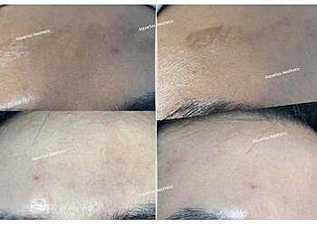 Outram Medical Spas Aquarius Aesthetic image 3 Outram Medical Spas Aquarius Aesthetic image 3