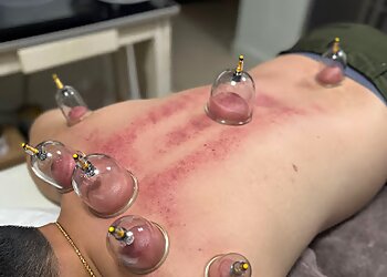 Punggol Traditional Chinese Medicine Ed-Cupoint TCM Therapy image 2 Punggol Traditional Chinese Medicine Ed-Cupoint TCM Therapy image 2