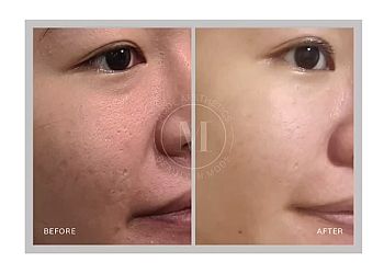 Bedok Medical Spas MODE Aesthetics Bedok image 3 Bedok Medical Spas MODE Aesthetics Bedok image 3