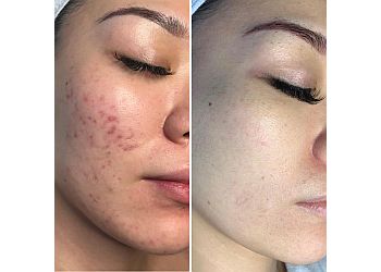 Pasir Ris Medical Spas New York Skin Solutions White Sands image 3 Pasir Ris Medical Spas New York Skin Solutions White Sands image 3