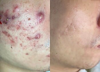 Pasir Ris Medical Spas New York Skin Solutions White Sands image 2 Pasir Ris Medical Spas New York Skin Solutions White Sands image 2