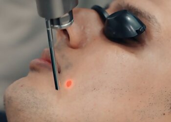 Pasir Ris Medical Spas V Medical Aesthetics & Laser Clinic White Sands image 2 Pasir Ris Medical Spas V Medical Aesthetics & Laser Clinic White Sands image 2