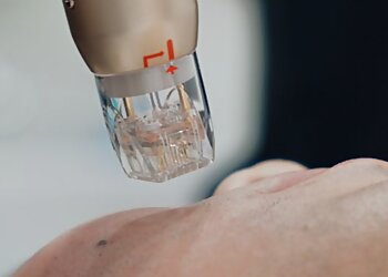 Pasir Ris Medical Spas V Medical Aesthetics & Laser Clinic White Sands image 3 Pasir Ris Medical Spas V Medical Aesthetics & Laser Clinic White Sands image 3