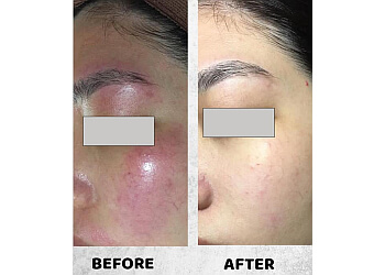 Ang Mo Kio Beauty Salons in Beauty Pte Ltd Ang Mo Kio image 3 Ang Mo Kio Beauty Salons in Beauty Pte Ltd Ang Mo Kio image 3